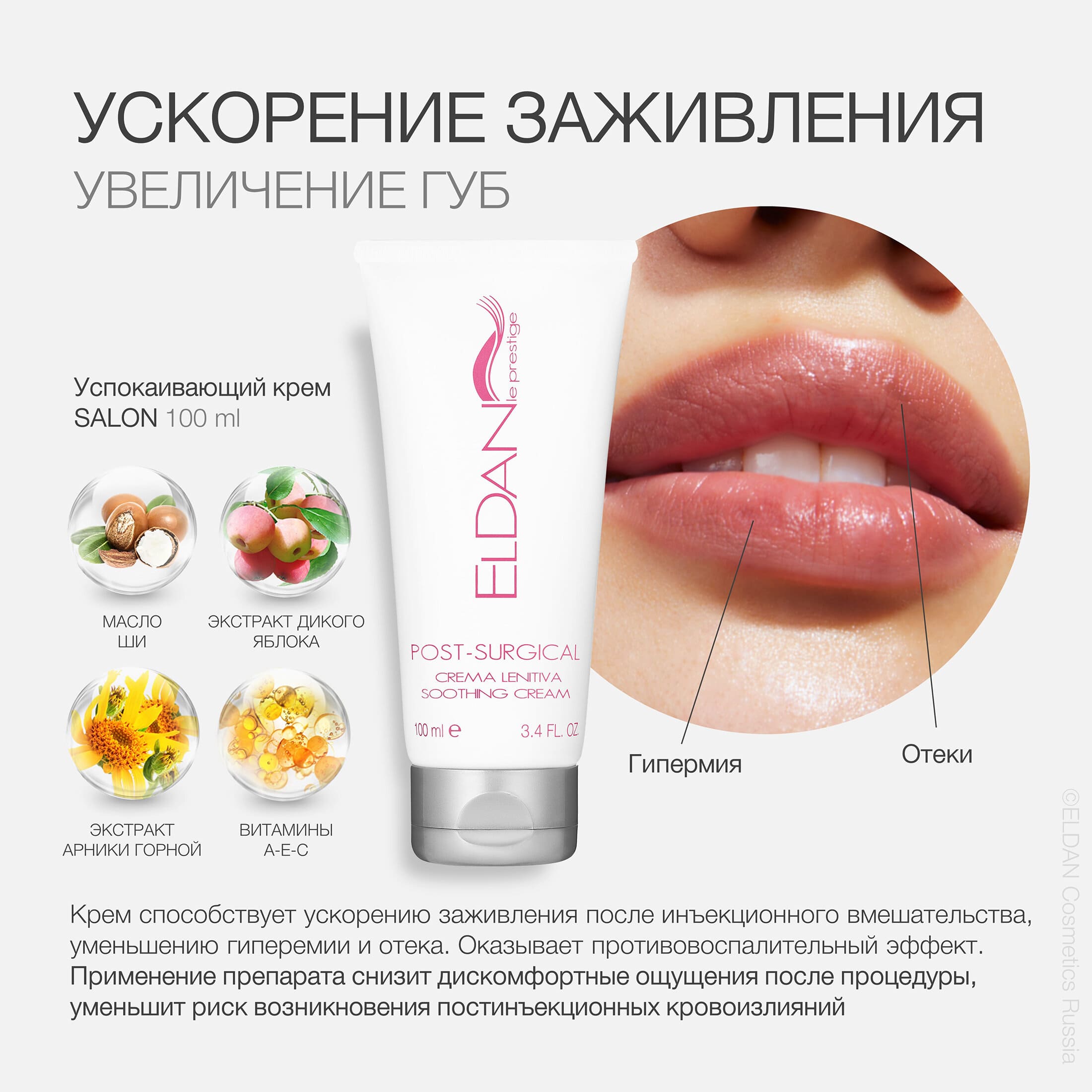 Пост увеличение губ 3.jpg Пост увеличение губ 3.jpg